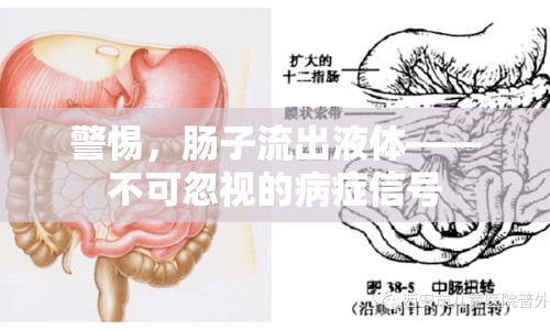 警惕，腸子流出液體——不可忽視的病癥信號