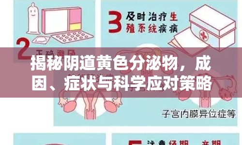 揭秘陰道黃色分泌物，成因、癥狀與科學應對策略