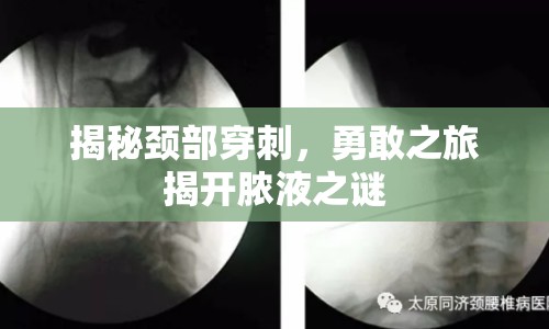 揭秘頸部穿刺，勇敢之旅揭開膿液之謎