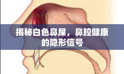 揭秘白色鼻屎，鼻腔健康的隱形信號