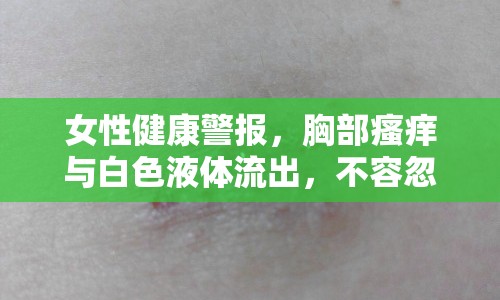 女性健康警報，胸部瘙癢與白色液體流出，不容忽視的信號