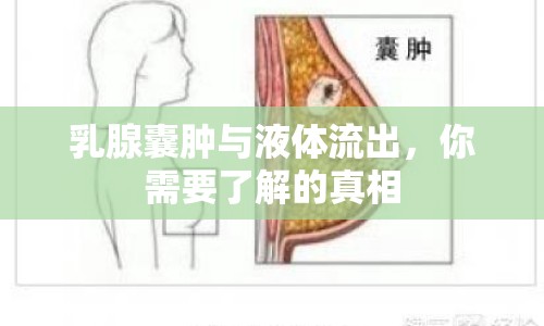 乳腺囊腫與液體流出，你需要了解的真相