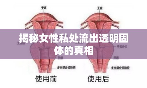 揭秘女性私處流出透明固體的真相