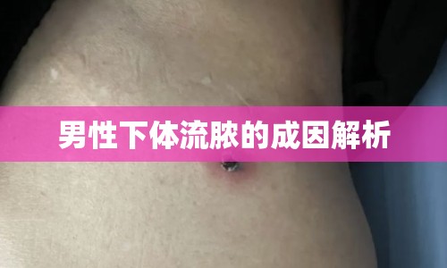 男性下體流膿的成因解析