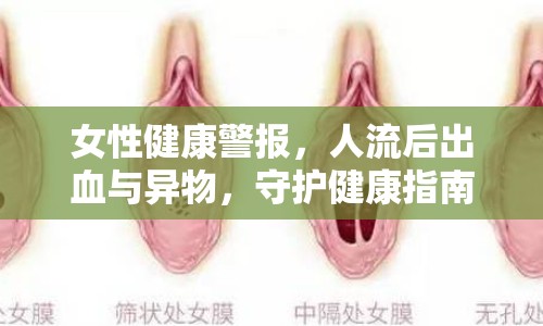 女性健康警報，人流后出血與異物，守護健康指南