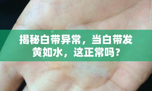 揭秘白帶異常，當(dāng)白帶發(fā)黃如水，這正常嗎？