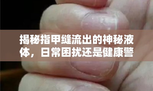 揭秘指甲縫流出的神秘液體，日常困擾還是健康警報？