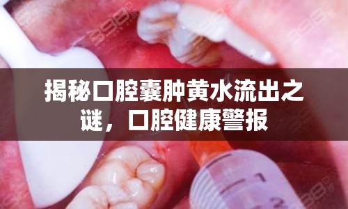 揭秘口腔囊腫黃水流出之謎，口腔健康警報