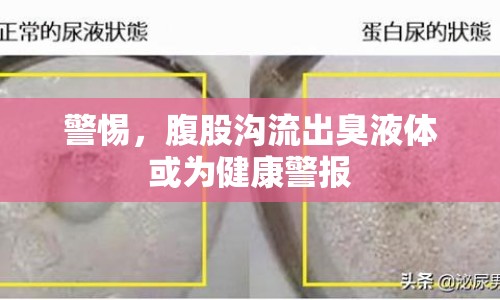 警惕，腹股溝流出臭液體或為健康警報