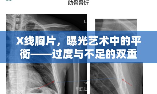 X線胸片，曝光藝術中的平衡——過度與不足的雙重考量