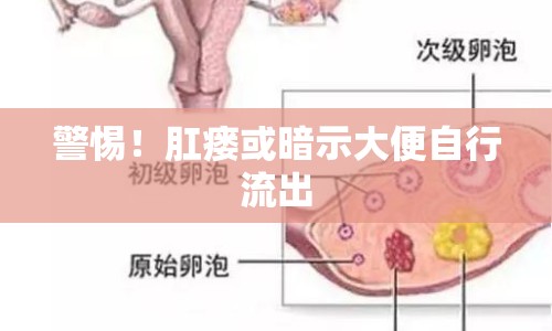 警惕！肛瘺或暗示大便自行流出