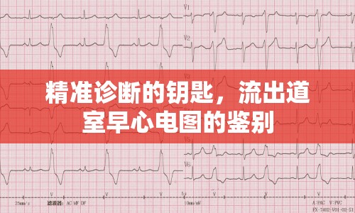 精準診斷的鑰匙，流出道室早心電圖的鑒別