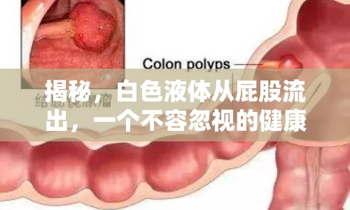 揭秘，白色液體從屁股流出，一個(gè)不容忽視的健康警示