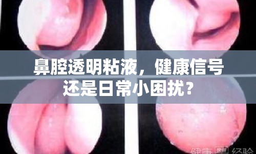 鼻腔透明粘液，健康信號還是日常小困擾？