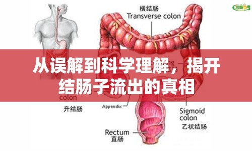 從誤解到科學(xué)理解，揭開結(jié)腸子流出的真相