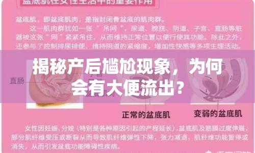 揭秘產后尷尬現(xiàn)象，為何會有大便流出？