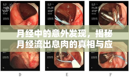 月經(jīng)中的意外發(fā)現(xiàn)，揭秘月經(jīng)流出息肉的真相與應(yīng)對策略