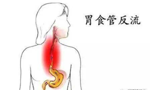 吃完東西后食道粘液流出問題解析