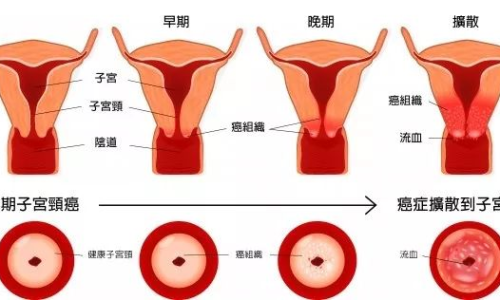 陰蒂流出，女性生理健康的微妙變化與關(guān)注重要性